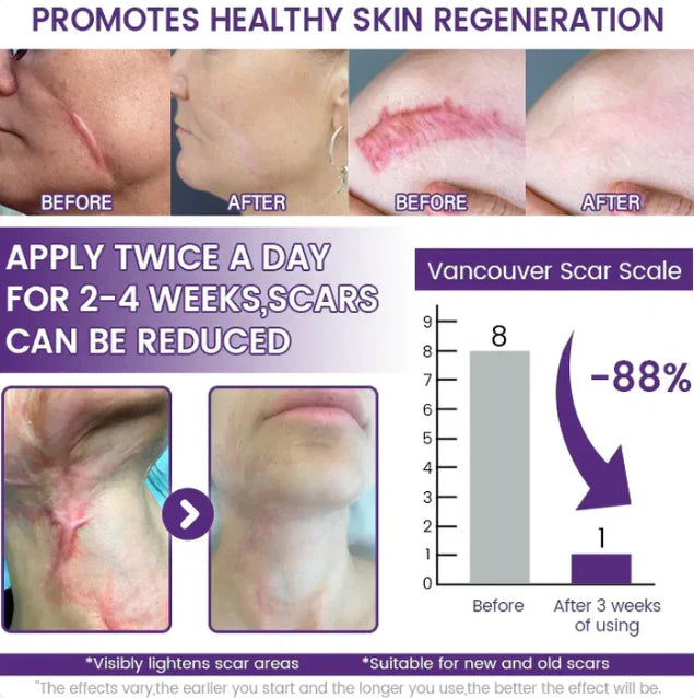 💥New on sale 2026 💞Stem Cell Scar Gel